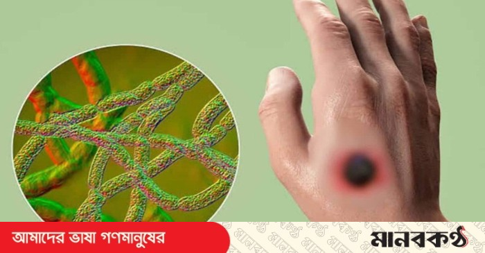 Qora gey porno Kaktusni vaginaga kiriting